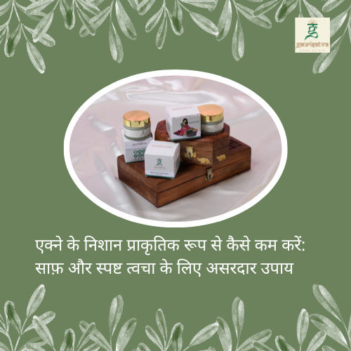 एक्ने के निशान प्राकृतिक रूप से कैसे कम करें: साफ़ और स्पष्ट त्वचा के लिए असरदार उपाय