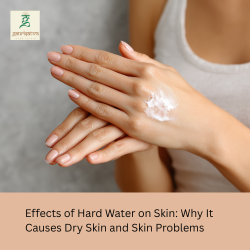 effects of hard water on skin​