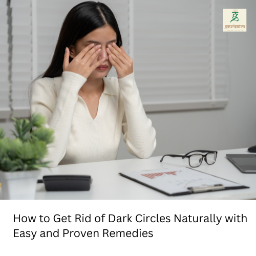 How to Get Rid of Dark Circles Naturally with Easy and Proven Remedies