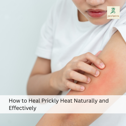 how to heal prickly heat