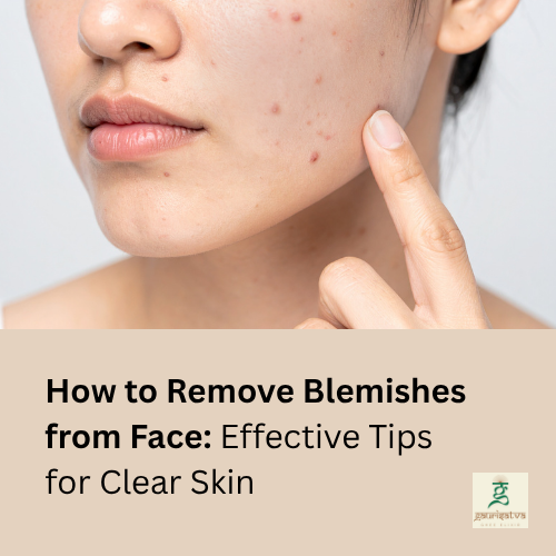 how to remove blemishes from face​