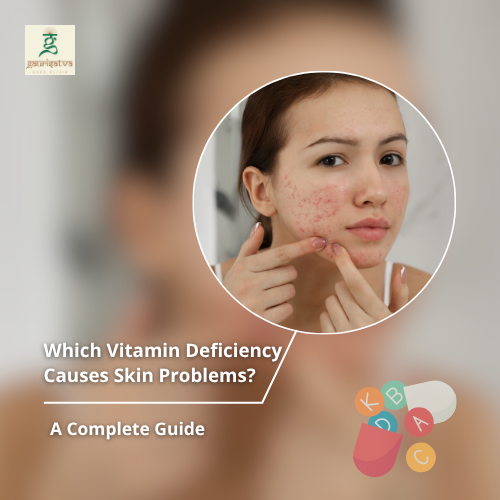 Which Vitamin Deficiency Causes Skin Problems? A Complete Guide