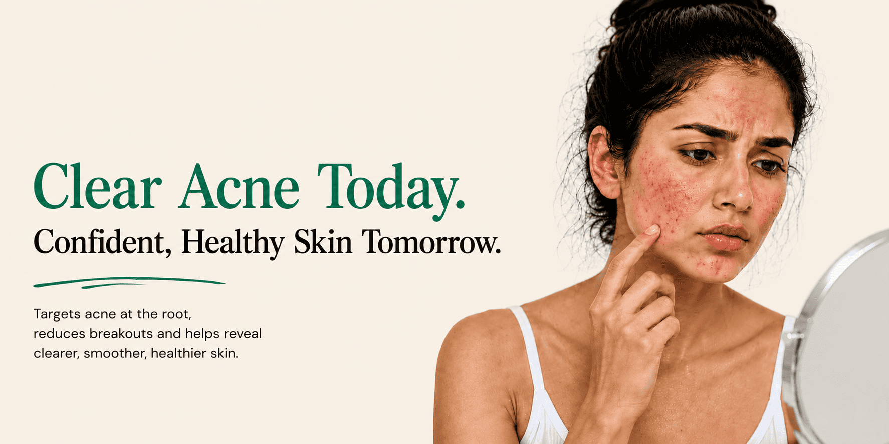 Acne Removal